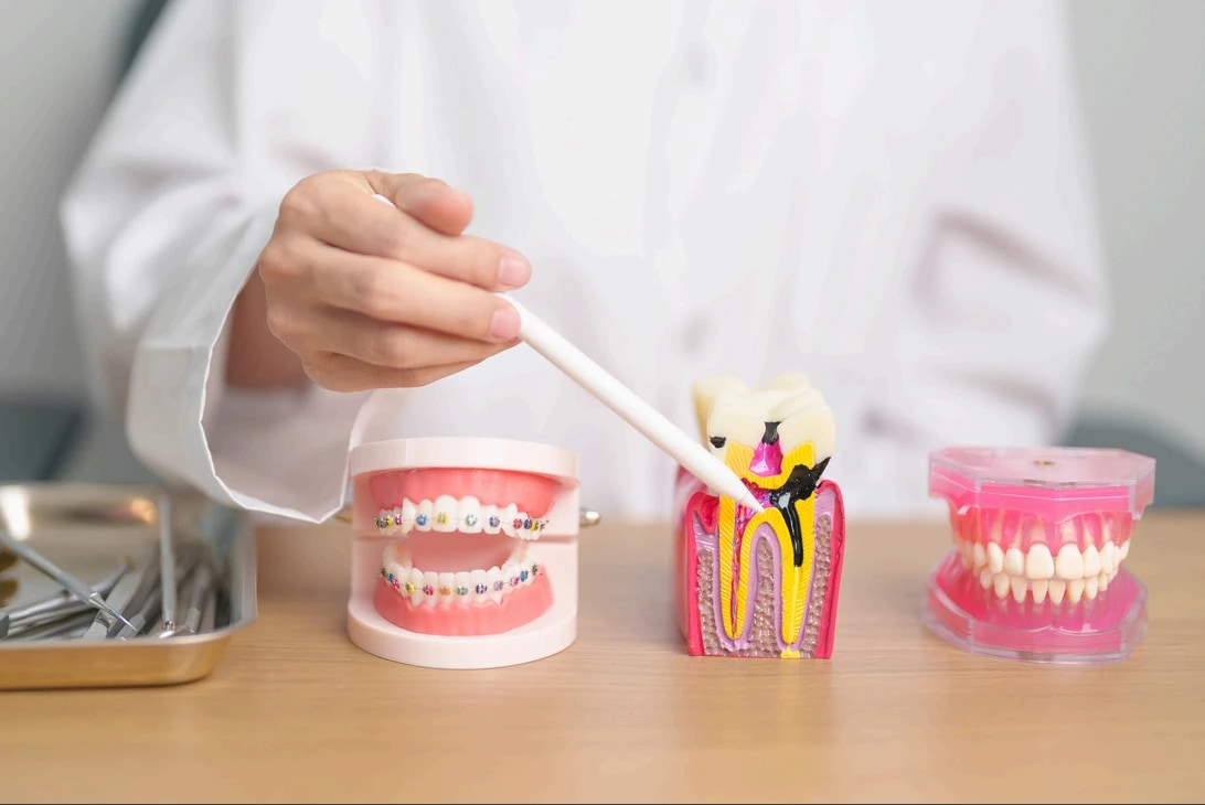 GN Dental Yuba City | Condiciones que Tratamos