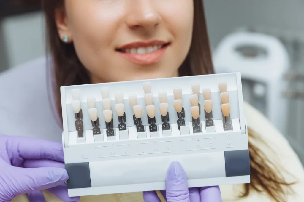 GN Dental Yuba City | Carillas de Composite