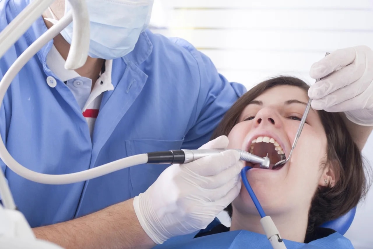 GN Dental Yuba City | Tratando una caries