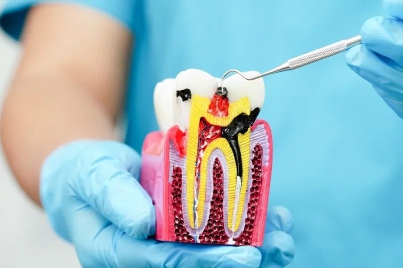 Tooth anatomical model for patient consultation