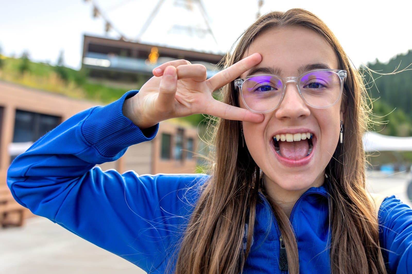 GN Dental Yuba City | Invisalign patient with straightened teeth