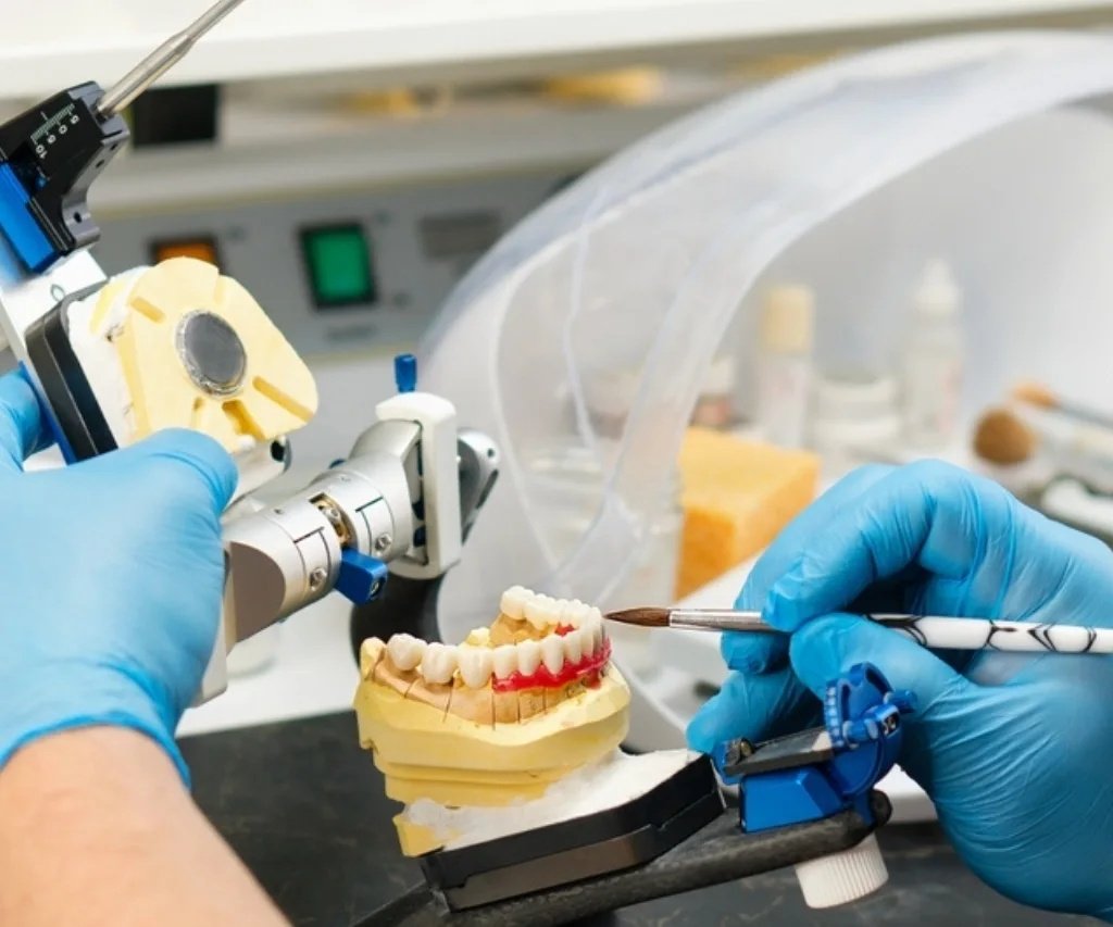 GN Dental Yuba City|Dental Crowns & Bridges